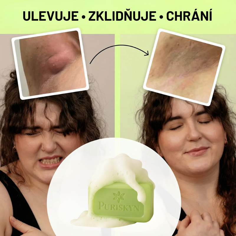 Antimikrobiální - mýdlo na zmírnění problémů