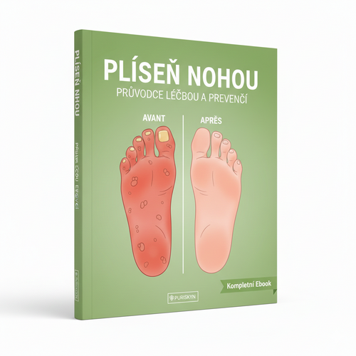 Průvodce e-knihou o antimykotických infekcích